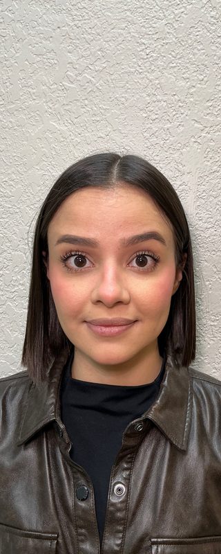 Resultado depois de procedimento estético na EZ Aesthetics & Wellness, Orlando — caso 4