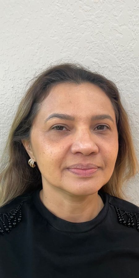 Antes do procedimento estético — caso 9 da EZ Aesthetics & Wellness, Orlando