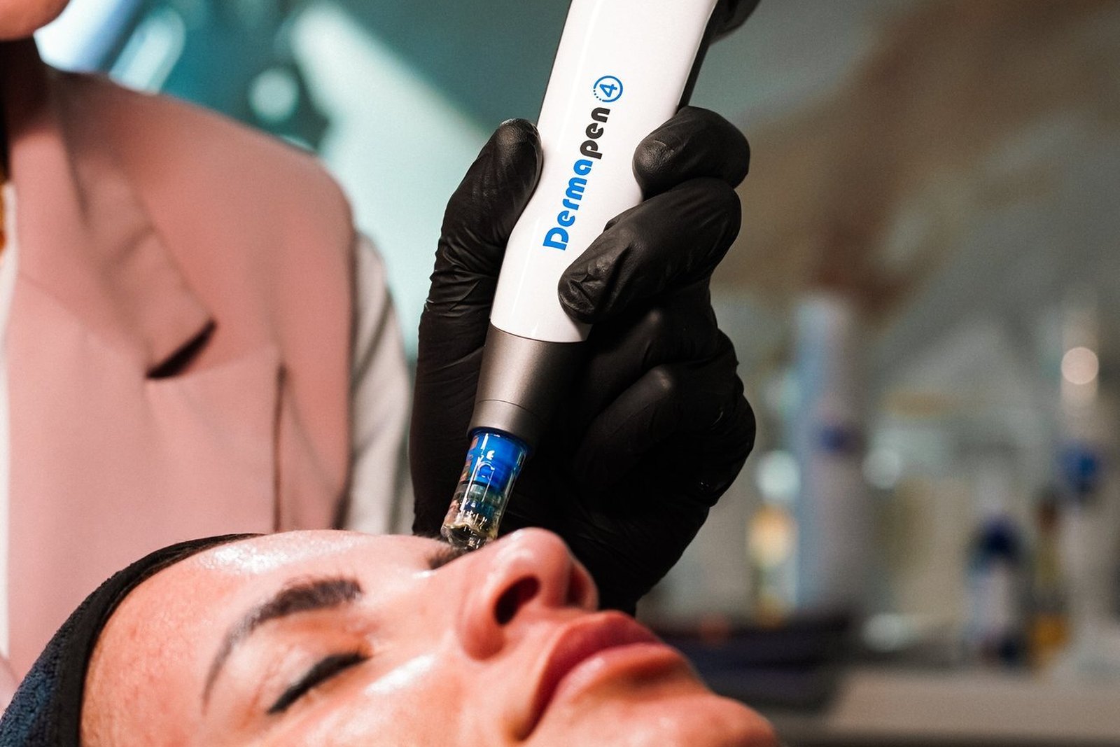 Procedimento de microagulhamento em Orlando com drug delivery na clínica EZ Aesthetics & Wellness