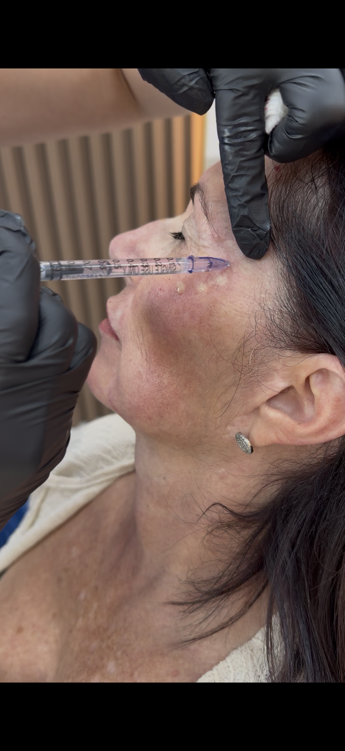 Procedimentos corporais em Orlando — EZ Aesthetics & Wellness