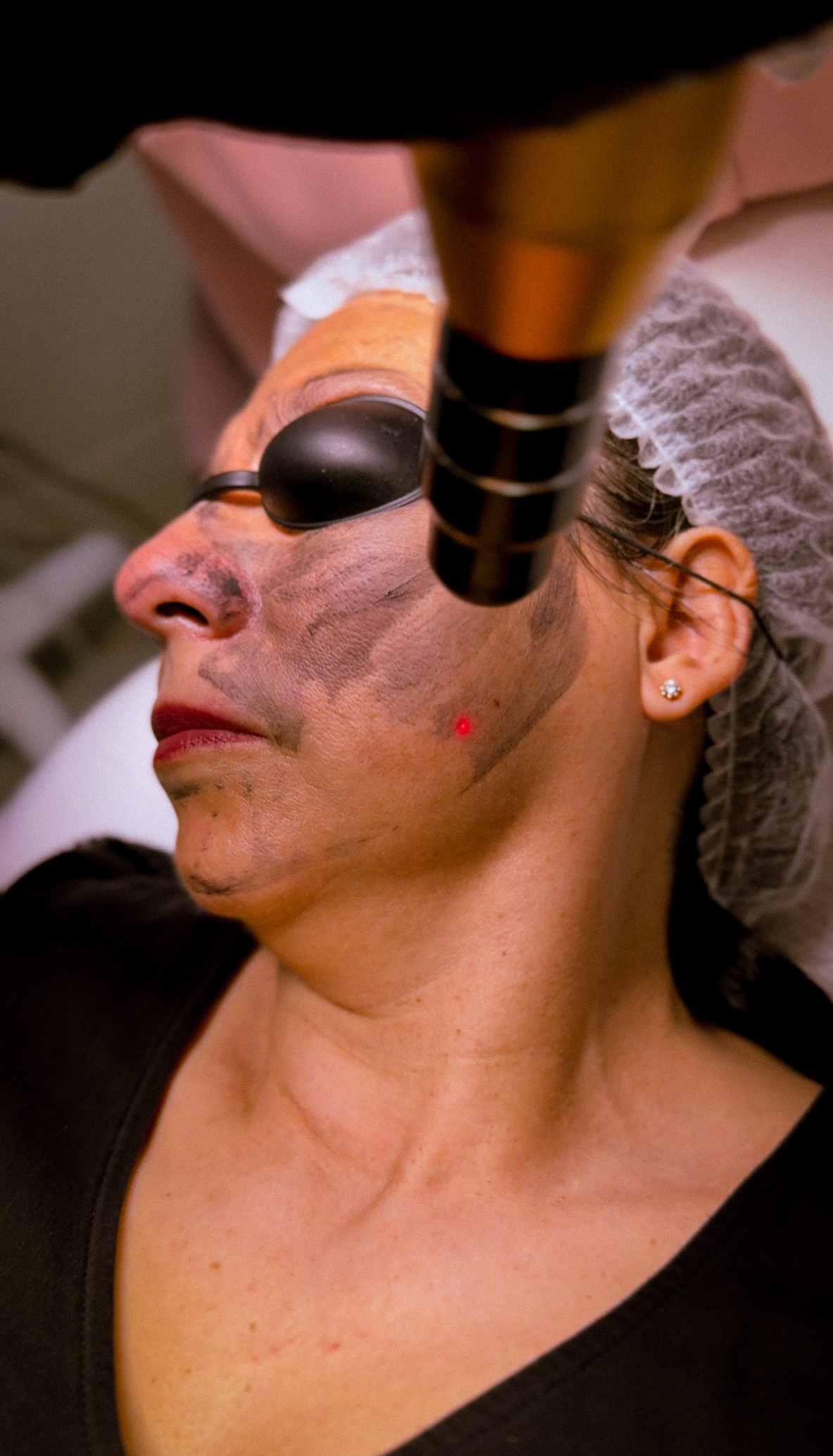 Procedimento estético em Orlando, FL — EZ Aesthetics & Wellness